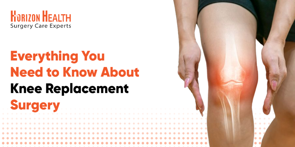 Everything You Need to Know About Knee Replacement Surgery