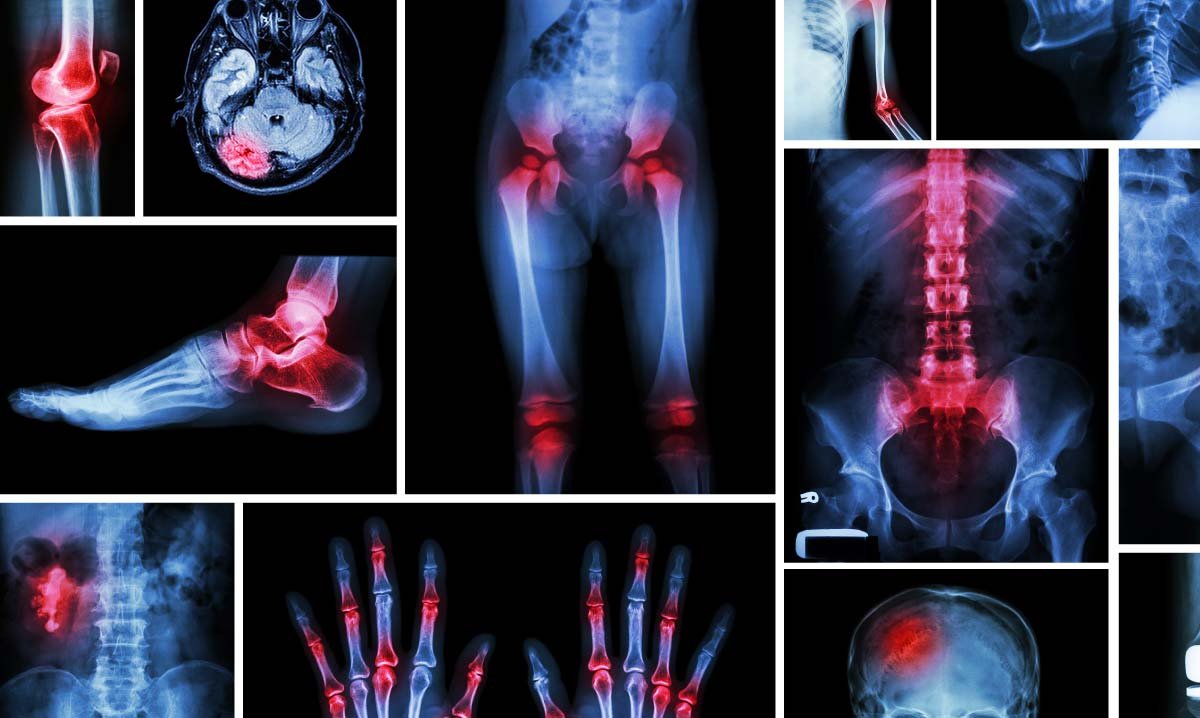 Orthopedic Treatment
