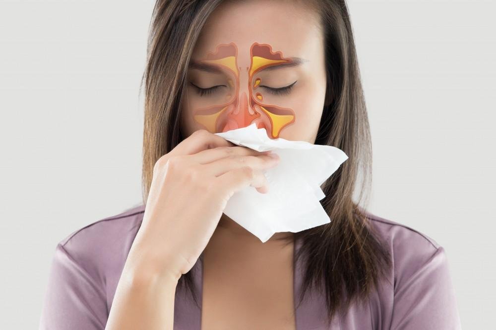 Sinusitis treatment