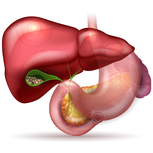 Gallstones Treatment